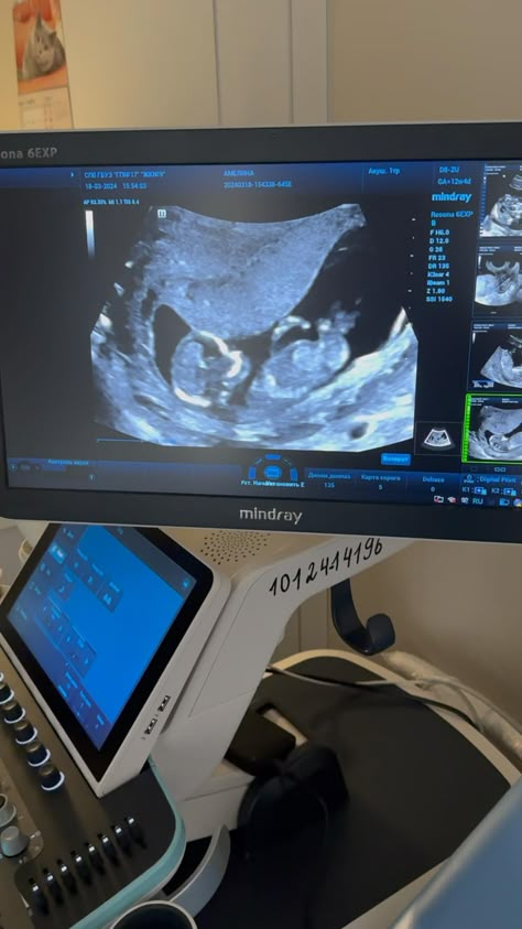 Ultrasound Video Pregnancy, 4 Week Ultrasound, Pregnancy Ultrasound Photos, 15 Week Ultrasound, Pregnant Flicks, Ultrasound Video, Pregnant Videos, Pregnancy Video, Baby Ultrasound Pictures