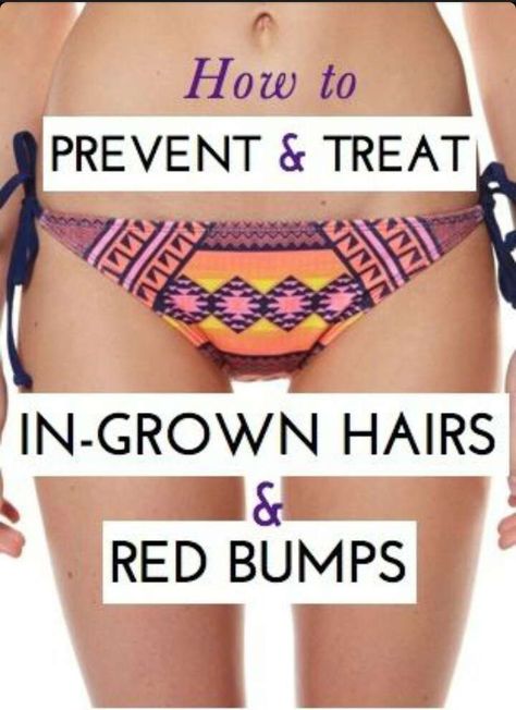 Healthy Nails Remedies Ingrown Hairs, Regrow Hair, Coachella Outfit, Beauty Remedies, Vanessa Hudgens, Ingrown Hair, Health And Beauty Tips, Grow Hair, All Things Beauty