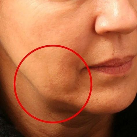 NATURAL FACE REJUVENATION on Instagram: "LET'S GET RID OF SAGGING JOWLS FOREVER 👊 Bookmark this simple exercise 💾and remember to repeat it every day ⠀ You may feel mild numbness, slight burning, or fatigue in your facial muscles. 👆🏻The exercise is performed at a slow pace. Make sure that the neck and back of the head are not strained. ⠀ 👉🏻👉🏻👉🏻👉🏻👉🏻 ______________ ❗️ To join the course visit my website using the link in the account description" Sagging Jowls, Face Rejuvenation, Simple Exercise, Facial Exercises, Facial Muscles, Face Yoga, Natural Face, Deep Thought Quotes, Online Course