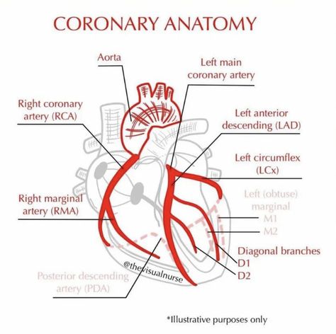 Coronary Arteries Anatomy, Coronary Circulation, Coronary Angiography Views, Pulmonary Artery Catheter, Paramedic School, Medical Videos, Nursing School Humor, Coronary Arteries, Basic Anatomy And Physiology