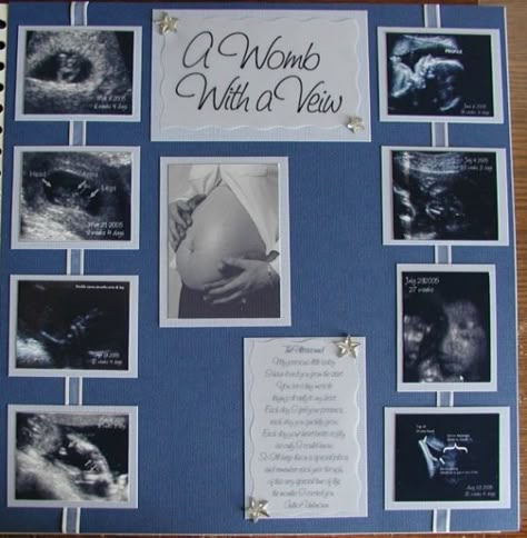 Ultrasound Pictures Scrapbook, Sonogram Scrapbook Page Ideas, Ultrasound Scrapbook Ideas, Maternity Scrapbook Ideas, Baby Scrapbook Pages Layouts, Scrapbook Ideas For Baby Boy, Baby Scrapbook Page Ideas, Newborn Scrapbook Ideas, Pregnancy Scrapbook Pages