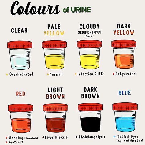 Pee Color, Color Of Urine, Urine Color, Methylene Blue, Urinary System, Light In The Dark, Quick Saves, Color