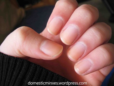 nail files bare all - Google Search Quick Nail Growth, Nail Symptoms, Nail Shape And Length, Naked Nails, Short Natural Nails, Body Neutrality, Rare Aesthetic, Bare Nails, Shifting Board