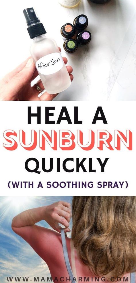 Doterra Sunburn, Heal Sunburn Fast, Essential Oil For Sunburn, Heal Sunburn, Essential Oil Spray Recipes, Natural Remedies For Sunburn, Sunburn Remedies, Sunburn Relief, Doterra Essential Oils Recipes