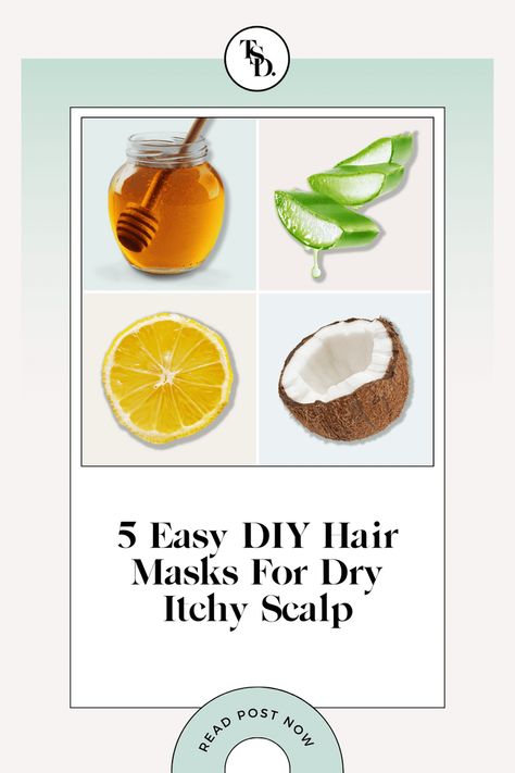 Diy Hair Mask For Dandruff, Psoriatic Skin, Scalp Remedies, Dry Scalp Remedy, Organic Hair Mask, Easy Diy Hair, Hair Mask For Dandruff, Scalp Mask, Homemade Hair Mask