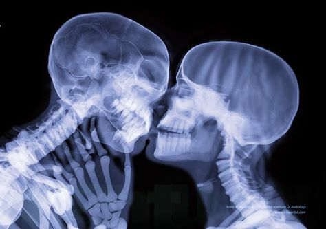 How romantic is kissing, really? It's just crushing your skulls together. Kissing Skulls, Deftones Change, Xray Art, Stacy London, Calendar Clock, People Kissing, Stay Forever, Best Teeth Whitening, The Skeleton