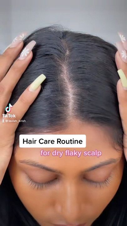 Dry Flaky Scalp, Curly Hair Mousse, Oils For Dandruff, Hair Washing Routine, Dry Itchy Scalp, Flaky Scalp, Hair Care Regimen, Best Hair Oil, Hair Dandruff