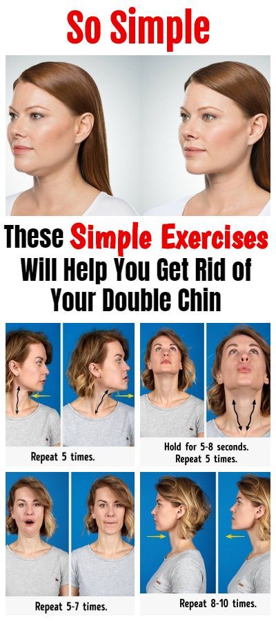 Cheek Fat, Reduce Face Fat, Jawline Exercise, Face Fat Loss, Double Chin Exercises, Reduce Double Chin, Chin Exercises, Face Fat, Double Menton