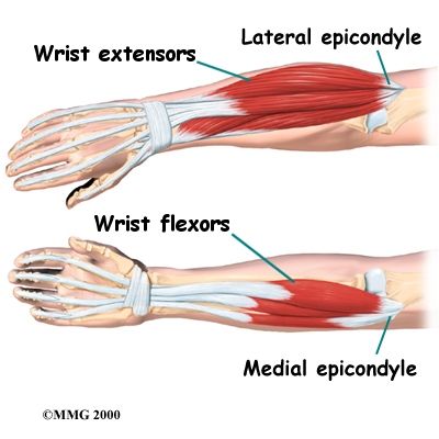 Wrist extensors (pronated ulnar-pinky side) Wrist flexors (supinated -ulnar pinky side) Elbow Anatomy, Forearm Workout At Home, Best Forearm Exercises, Golfers Elbow, Physical Therapist Assistant, Forearm Workout, Lymph Massage, Elbow Pain, Muscle Anatomy