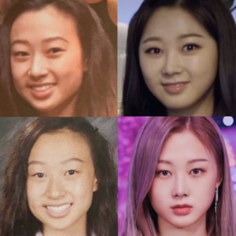 Aespa Before And After Surgery, V Shaped Jaw, Chin Whiteheads, Korean Rhinoplasty, Aespa Memes, Plastic Surgery Video, Beauty Surgery, Kpop Plastic Surgery, Buccal Fat Removal