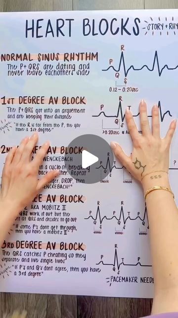 St Elevation Ekg, Cardiac Nurse Aesthetic, Er Nursing, Ekg Technician Aesthetic, Cvicu Nursing, Ekg Nursing, Paramedic Student, Residency Medical, St Elevation