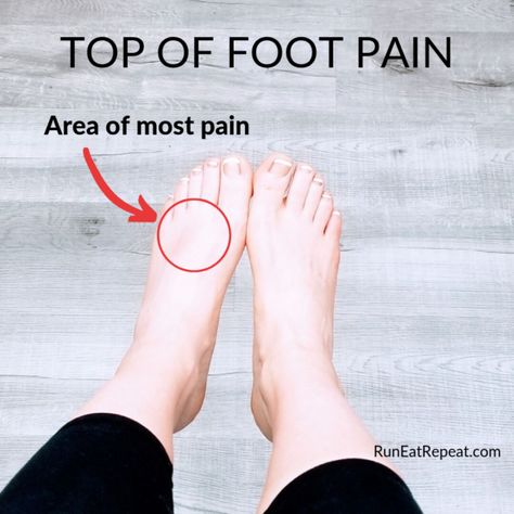 top of foot pain for runners Foot Spurs Remedies Heel Pain, Top Of Foot Pain, Extensor Tendons Foot Stretches, Supraspinatus Tendon Tear, Running After Injury, Achilles Tendinopathy, Achilles Pain, Foot Stretches, Running Injury Prevention