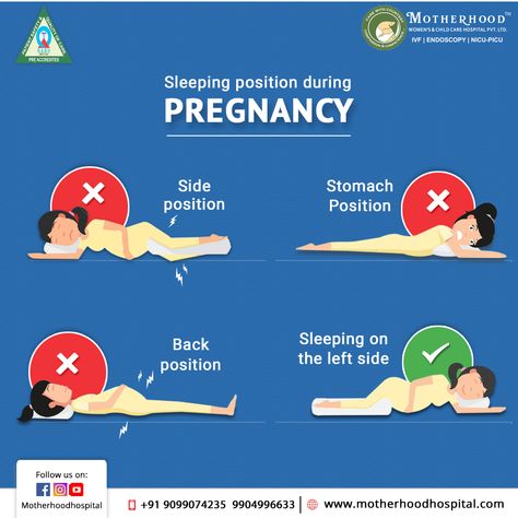 Correct Sleeping Positions, Right Way To Sleep, Sleeping While Pregnant, Pregnancy Sleeping Positions, Best Sleeping Positions, Best Pregnancy Workouts, Sleeping On Back, Obstetrics Nursing, Fertilization Process