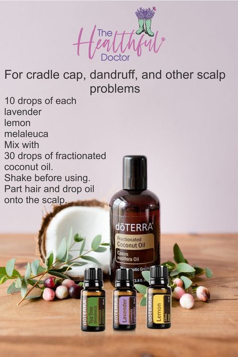 Essential Oils For Dandruff Doterra, Essential Oils For Dry Scalp, Essential Oils For Dandruff, Dandruff Essential Oil, Doterra Hair, Oils For Hair Growth, Home Remedies For Dandruff, Oils For Dandruff, Doterra Oils Recipes