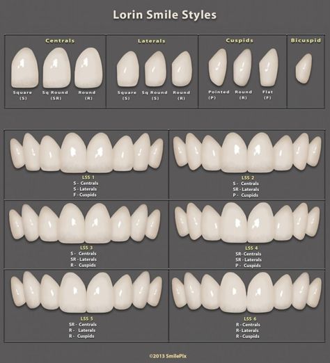 Tooth Template, Dental Photos, Dental Aesthetics, Veneers Teeth, Aesthetic Dentistry, Beautiful Teeth, Perfect Teeth, Dental Laboratory, Teeth Shape