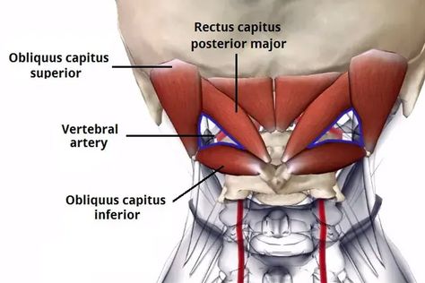 The Ultimate Guide to the Suboccipital Muscles - Iron Neck Suboccipital Muscles, Neck Muscle Anatomy, Anatomy Pictures, Severe Neck Pain, Head Muscles, Occipital Neuralgia, Vertebral Artery, Muscle Stretches, Craniosacral Therapy