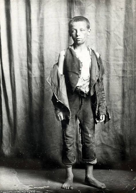 A young boy with torn clothes and a dirty face poses for a picture, Liverpool, 1900. The remarkable photos from the Liverpool City Library and the Records Office certainly offer an unflinching glimpse as to what life was like for our poor ancestors Ragged Clothes, Face Poses, Torn Clothes, Liverpool History, Victorian Life, City Library, Liverpool City, Victorian Photos, The Great