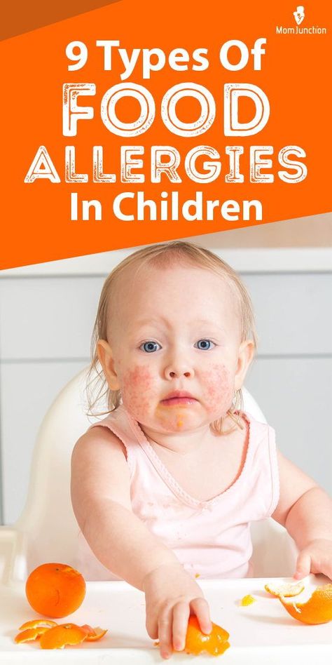 Allergic Reaction Remedies, Toddler Allergies, Allergic Reaction Rash, Home Remedies For Allergies, Natural Remedies For Migraines, Kids Allergies, Improve Nutrition, Allergy Remedies, Peanut Allergy