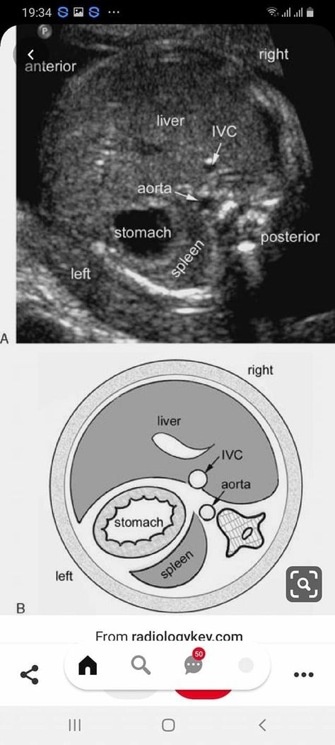 Ultrasound Student, Fetal Ultrasound, Diagnostic Medical Sonography Student, Ultrasound School, Ultrasound Physics, Obstetric Ultrasound, Cardiac Sonography, Sonography Student, Radiologic Technology