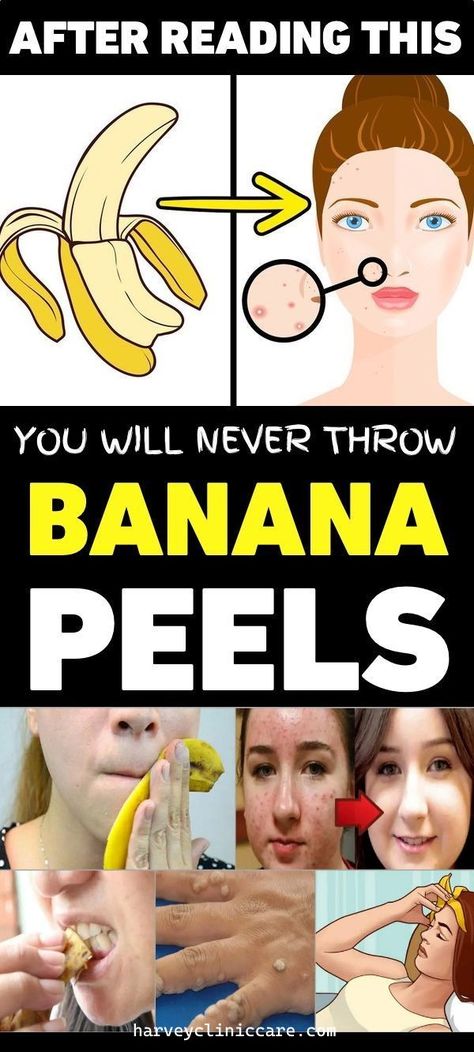 Banana Peel Remedies – You Will Never Throw The Banana Peel After Reading This Home Medicine, Eating Bananas, Healthy Advice, Natural Health Care, Banana Peel, A Banana, Good Health Tips, Natural Health Remedies, Health And Beauty Tips