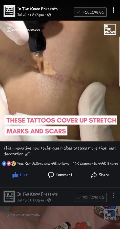 Makeup tattoo to cover up scars and stretch marks Tattoo To Cover Scar From Surgery, Tummy Tucks Tattoo Cover Up, Scar Cover Up Tattoo, Stretch Mark Tattoo, Tummy Tattoo, Tattoos To Cover Scars, Mark Tattoo, Makeup Tattoo, Losing 40 Pounds