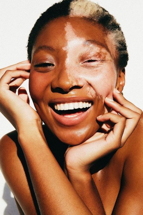 Body Imperfections Photography, Face Care Aesthetic, Clean Girl Aesthetic Skincare, Skincare Girl Aesthetic, Imperfection Photography, Aesthetic Skincare Products, Skincare Girl, Aesthetic Face, Aesthetic Clean