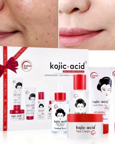 "Say goodbye to hyperpigmentation and hello to radiant, even-toned skin with our Kojic Acid Set! This powerful skincare duo is formulated with kojic acid, a natural ingredient that inhibits melanin production and reduces the appearance of dark spots, acne scars, and freckles. Our Kojic Acid Set includes: Kojic Acid Serum (10%): A concentrated serum that targets hyperpigmentation and promotes collagen production. Kojic Acid Cream (5%): A rich and nourishing cream that hydrates and brighten... Kojic Acid Skincare Routine, Korean Skin Care For Hyperpigmentation, Valitic Kojic Acid Dark Spot Remover, Kojic Acid Serums, Cosrx Hyaluronic Acid Intensive Cream, Hyperpigmentation Skincare, Keratosis Pilaris, Tranexamic Acid, Acne Care