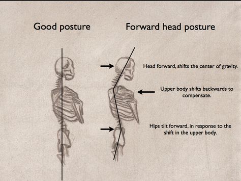 Great diagram showing forward head posture Help With Posture, Forward Head Posture Exercises, Posture Fix, Text Neck, Neck And Shoulder Muscles, Forward Head Posture, Pinched Nerve, Physical Therapy Exercises, Body Wellness