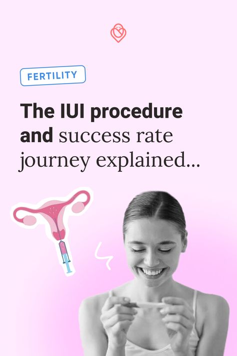 "If you’ve been trying, unsuccessfully, to fall pregnant and are ready to start exploring your options for assisted conception, intrauterine insemination (IUI) can be a good place to start, depending on your specific circumstances." If you’re wondering what the IUI procedure is, what it feels like and what its success rate is, click this post to keep reading. Fertility Manifestation, Iui Success Tips, Iui Procedure, Iui Success, Preconception Health, Manifestation Inspiration, Cervical Mucus, Assisted Reproductive Technology, Sanitary Products