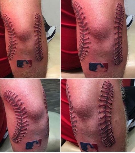 Baseball ball elbow scar tattoo Softball Tattoos, Baseball Tattoo, Baseball Tattoos, Tattoos To Cover Scars, Stitch Tattoo, Scar Tattoo, Elements Tattoo, Bat Tattoo, Baseball Stitch