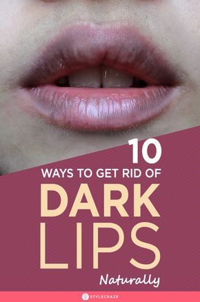 10 Proven Ways To Get Rid Of Dark Lips Naturally – Worked For 99% People Who Tried: Apart from using expensive  lip scrubs and peels, you can make some easy lip packs yourself to remove the dark and ugly pigmentation. Here are some tips and recipes you should follow to lighten your dark lips. #Beauty #BeautyTips #Lips #LipCare #DarkLips #Remedies Remedies For Dark Lips, Watermelon Lip Scrub, Honey Lip Scrub, Natural Lip Scrub, Lip Lightening, Throbbing Headache, Lip Scrub Recipe, Lip Scrub Homemade, Lip Scrub Diy