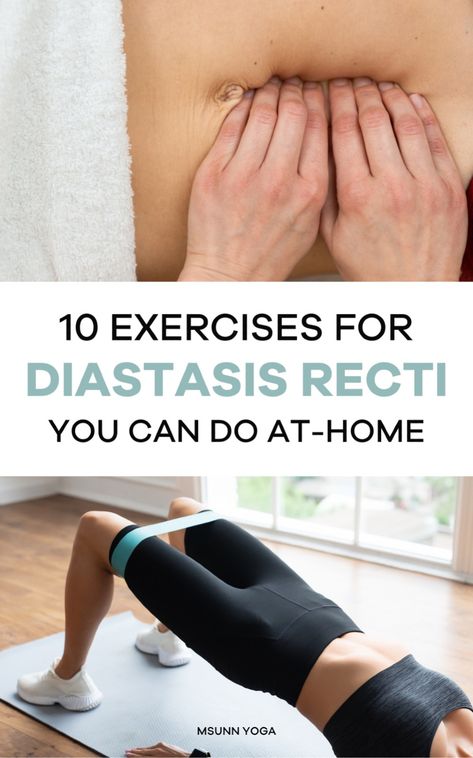 Workouts For Diastasis Recti, Workout For Diastasis Recti, Exercises For Diastasis Recti, Diastasis Recti Repair, Best Lower Ab Exercises, Postpartum Yoga, Pelvic Floor Muscle Exercise, Yoga Videos For Beginners, Healing Diastasis Recti