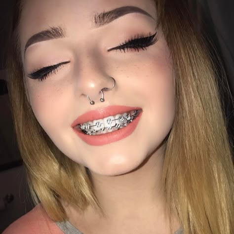 Braquets ❤ Braces Girl, Braces Ideas, Braces Smile, Cute Braces Colors, Girls With Braces, Mouth Piercings, Getting Braces, Braces Girls, Cute Braces