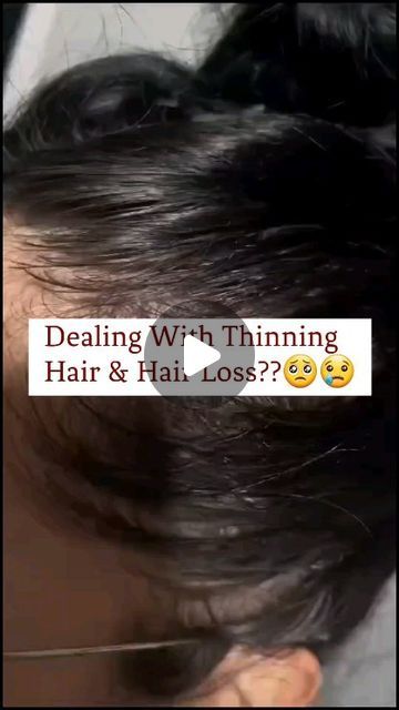 Glam In You on Instagram: "Dealing With Thinning Hair & Hair Loss 🥺😢 #reels   #reelsinstagram #reelsinsta #reelsvideo #reelkarofeelkaro #reelitfeelit #diyhairrecipes #hairregrowthtreatment #haircare #hairtreatmentathome #hairdamage #strengthenhair #stronghair #shinyhair #longhair #beautifulhair #onionforhair #essentialoil #vitamine #glassshine #supershine #trend #trendingsong #jamalkudu #animalmovie #animal #abrarsentry #viralsong #viralvideos #glam_in_you" Diy Hair Products Recipes, Insta Tips, Onion For Hair, Viral Song, Hair Regrowth Treatments, Thinning Hair, Hair Strengthening, Strong Hair, Shiny Hair