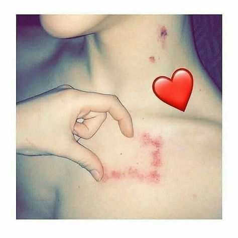 Hickies Neck Aesthetic Guy, Heart Of Hickeys, Boyz Dp, Couple With Baby, Couple Goals Teenagers Pictures, Love Poetry Images, Army Girlfriend Pictures, Wedding Couple Poses Photography, Cute Relationship Photos