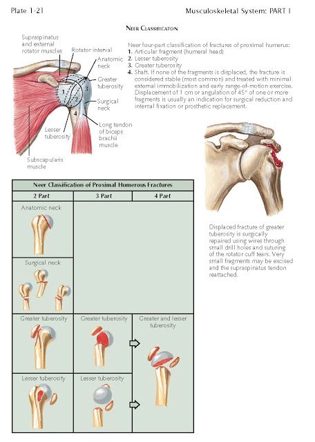 PROXIMAL HUMERAL FRACTURES   Neer Classification   Fractures of the proximal humerus are common, occur- ring most frequently in older pat... Humerus Fracture, Shoulder Anatomy, Rotator Cuff Tear, Healing Thoughts, Health Medicine, Musculoskeletal System, Medical School Studying, Rotator Cuff, After Surgery