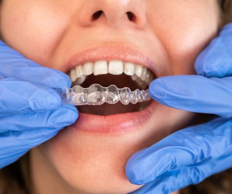 Picture Perfect Smile, Dental Mouthguards, Invisalign Aligners, Traditional Braces, Dental Braces, Clear Aligners, Dental Center, General Dentistry, Family Dentistry