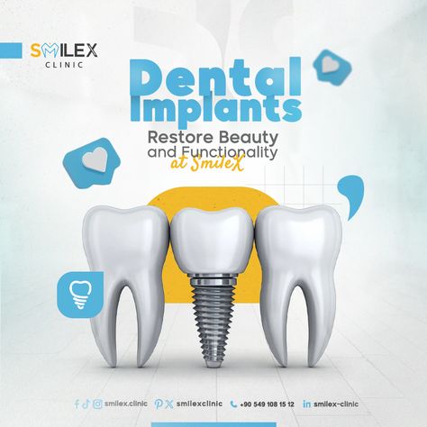 💪Dental Implants, Restore Beauty and Functionality at SmileX.  💪 Whether you're dealing with tooth loss due to injury or decay, dental implants are the optimal solution to regain a bright smile and efficient functions.  📞Schedule your appointment today you deserve the best.  ⚪ISTANBUL TÜRKÌYE  https://wa.me/905491081512⁠ ⁠ #orthodontics #straightteeth #veneers⁠ #tooth #dentalimplants #teethwhitening ⁠ #dentist #dental #dentistry #teeth⁠ #İstanbul #türkiye Dental Implant Poster, Dental Implants Creative Ads, Dental Poster Design, Dental Campaign, Dental Content, Dental Post, Dental Poster, Relax Photo, Dental Composite