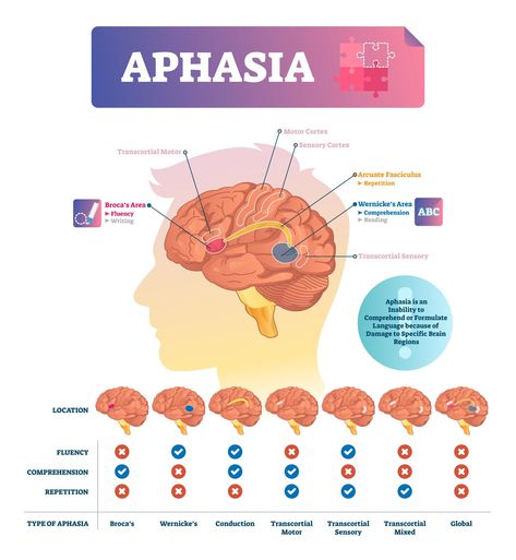 Types Of Speech, Speech Language Pathology Grad School, Brain Neurons, Language Disorders, Slp Activities, Receptive Language, Speech Therapy Materials, Speech Therapy Resources, Speech Therapist