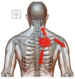 T4 Syndrome | ShoulderDoc by Prof. Lennard Funk Narrowing Of The Spine, Serratus Posterior, Muscle Imbalance, Restless Leg Syndrome, Upper Back Pain, Myofascial Release, Nerve Damage, Back Pain Exercises, Trigger Points