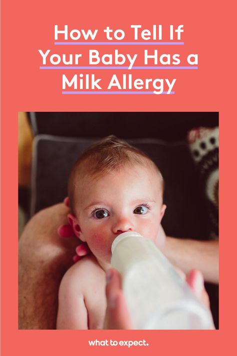 While you may have heard a lot about milk allergies and milk intolerance in babies, they're actually not that common. How To Introduce Allergens To Baby, Ounces Of Milk For Baby By Age, Dairy Allergy Baby, Dairy Allergy Symptoms, Milk Allergy Baby, Milk Protein Allergy Diet Breastfeeding, Lactose Intolerant Symptoms, Baby Food Allergies, Cows Milk Allergy