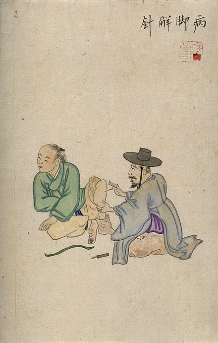 From Wikiwand: A Korean acupuncturist inserting a needle into the leg of a male patient. Wellcome Collection Korean Kingdom, Korean Medicine, Acupuncture Charts, Complementary Medicine, University Of Rochester, Wellcome Collection, Internal Organs, Ancient Kingdom, Free To Use Images