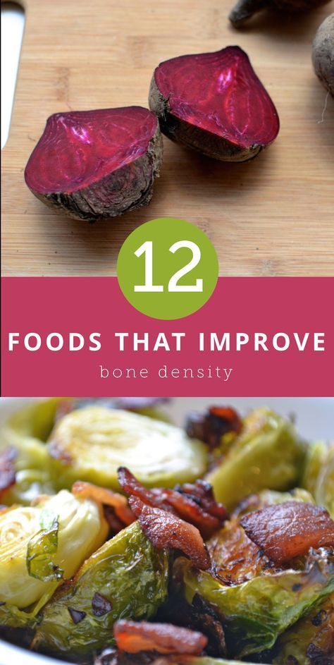 Bone Healing Foods, Osteoporosis Diet, Best Diet Foods, Best Fat Burning Foods, Healthy Bones, Bone Density, Healing Food, Fat Burning Foods, What To Eat