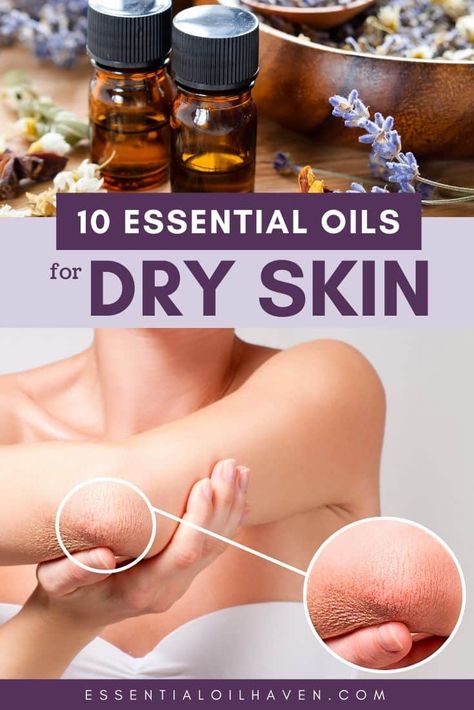 How to Treat Dry Skin with Essential Oils. Includes the Top 10 Essential Oils for Dry Skin. #dryskin #skincare #essentialoils Skin Oil Recipe, Essential Oils For Dry Skin, Oils For Dry Skin, Dry Skin On Face, Oil For Dry Skin, Skin Care Lotions, Skin Oil, Essential Oils For Skin, Cream For Dry Skin