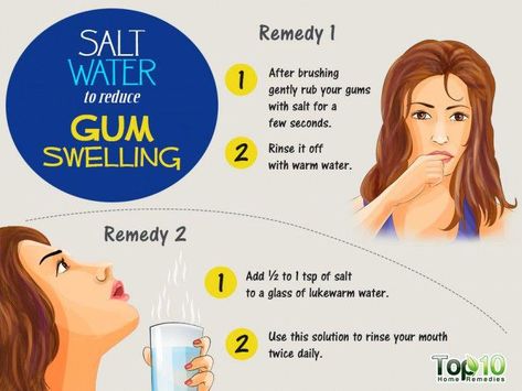 complete dental health Sore Gums Remedy, Mouth Health, Tooth Ache Relief, Remedies For Tooth Ache, Top 10 Home Remedies, Swollen Gum, Healthy Gums, Teeth Whitening Remedies, Tooth Pain