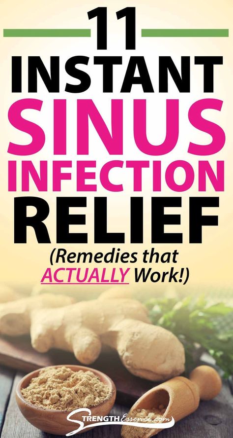 Sinus Natural Remedies, Diy Sinus Pressure Relief, Diy Sinus Relief, Yoga For Sinus Infection, Food For Sinus Infection, Relieve Sinus Pressure Nasal Congestion, Plugged Ears Remedy Sinus Infection, Diy Sinus Infection Remedies, Natural Sinus Pressure Relief