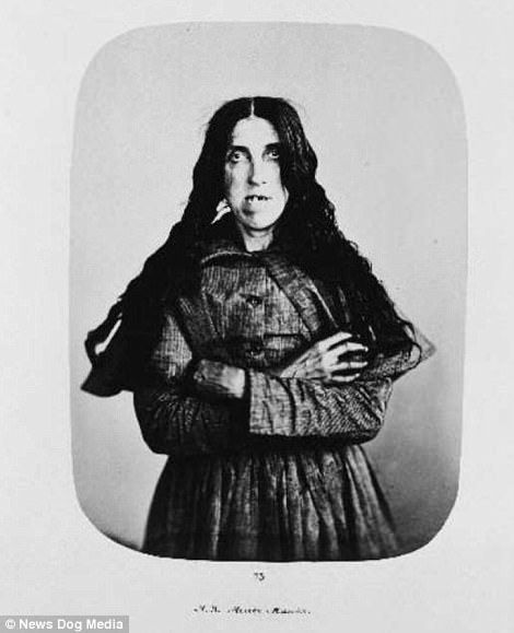 This female patient was diagnosed with acute mania and was treated at Bethlem Asylum, which was nicknamed Bedlam, in London Insane Asylum Patients, Images Terrifiantes, Lunatic Asylum, Mental Asylum, Mental Institution, Abandoned Asylums, Haunting Photos, Insane Asylum, Psychiatric Hospital