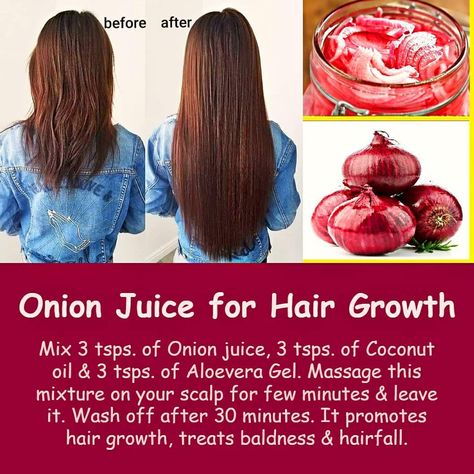 For Hair Growth Tips, Hair Oil Massage, Onion Juice For Hair Growth, Juice For Hair Growth, Onion Hair Mask, Hair Mask For Hair Growth, Juice For Hair, Onion Benefits, Mask For Hair Growth