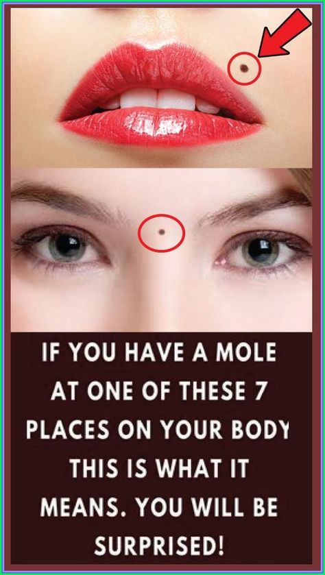 IF YOU HAVE A MOLE AT ONE OF THESE 7 PLACES ON YOUR BODY THIS IS WHAT IT MEANS. Mole Meaning, Red Moles, Are You Serious, Creating A Newsletter, Back Pain Exercises, Body Cleanse, Diy Health, Health And Fitness Tips, Blood Vessels