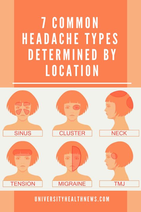 Headache is the most common form of pain. Although there are over 150 types of headache, only a few types are common. The location of your headache can help you know the type. « Previous Headache Location Meaning, Headache Meaning, Headache Location, Tension Migraine, Hangover Headache, Headache Types, Natural Headache Remedies, Health And Fitness Magazine, Tension Headache